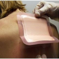 Smith & Nephew - Allevyn® - Adhesive Dressing - 66020043 - In Use