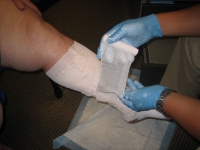 Medline - UNNA-Z™ - Unna Boot - NONUNNA3 - In Use