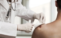 Cardinal Health™ - Dermacea™ - Gauze Sponge - 441000 - In Use