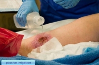 Nurse Assist - Sterile Water - 6250 - In Use