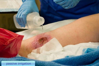 Picture of Sterile Water - Nurse Assist - KIT